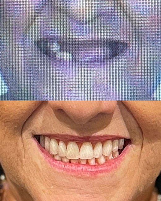 Casos-Antes-e-Depois