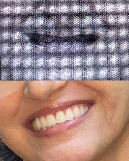 Casos-Antes-e-Depois2