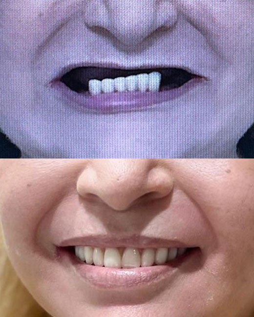 Casos-Antes-e-Depois3