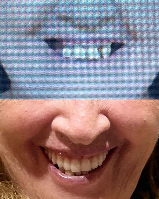 Casos-Antes-e-Depois4