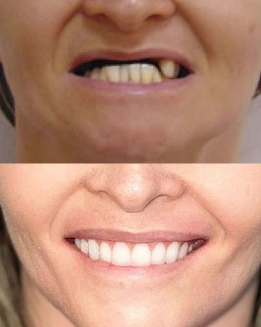 Casos-Antes-e-Depois5