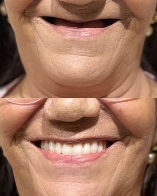 Casos-Antes-e-Depois6