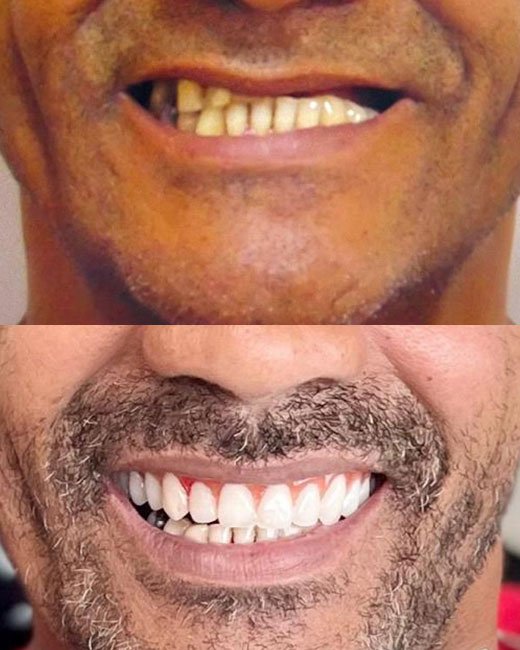 Casos-Antes-e-Depois7